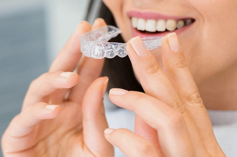 Kumra Orthodontics - Invisalign in Washington DC